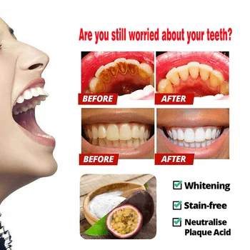 Intenzivno Stain Remover Zob zobna pasta Proti Krvavitev Dlesni z zobno Ščetko za Ščetkanje Zob TN88