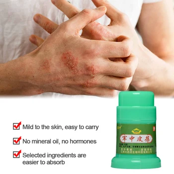 1Pcs Ekcem, Luskavica Zdravljenja Mazilo Dermatitis Anti Srbenje Čista Zeliščna Antibakterijska Krema Obliž za Nego Kože Problem Popravila