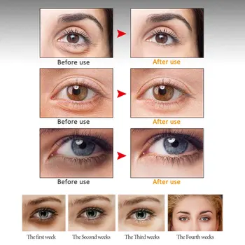 ARTISCARE Peptid Hranljiva Proti Gubam Eye Serum Roller Massager Anti-Zabuhlost Fine Linije Odstrani podočnjake Eye Cream