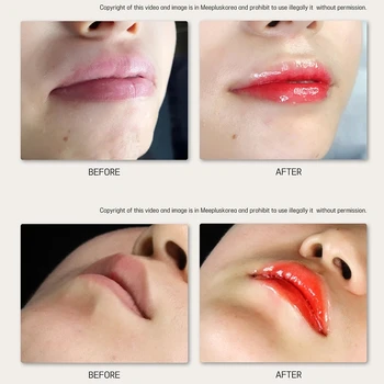 5PCS Koreja BB Ustnice korejski Ličila Ampul BB Krema za Trajno Lepoto Pigment Mesotherapy Multi-Barvni Ustnice Kolorit Več Temperament