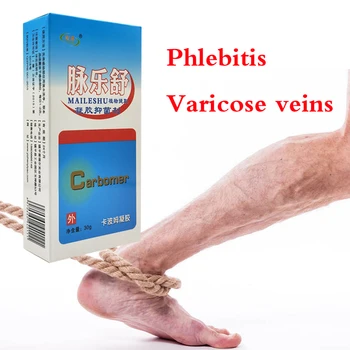 Kitajski Krčnih Veno Odstranitve Naravnega Zdravljenja za Lajšanje Phlebitis Angiitis Domov Sredstva za Krčne Žile Pajek Smetane