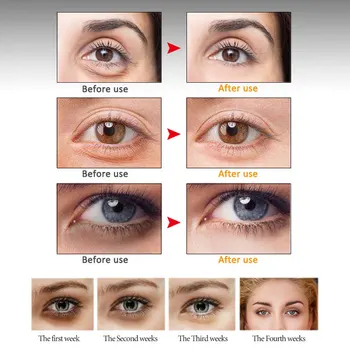 Adijo 4 Hitri 1 Peptid Kolagena Kremo za Oči Roller Oči Obliži Proti Gubam Anti-aging Odstranjevalec Temne Kroge Pred Oči Zabuhlost
