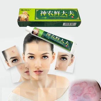 Kitajski medicinski Krema Vroče prodajo za nego kože, Dermatitis, Luskavica in Ekcem Pruritus Smetane